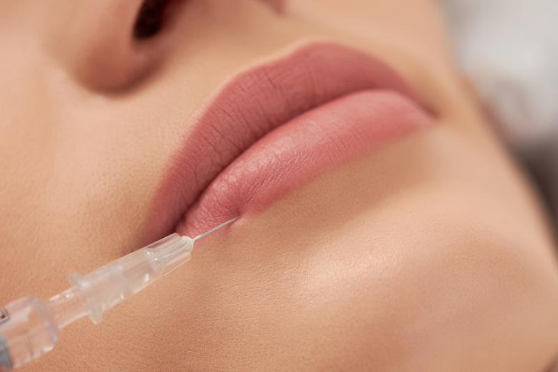 How Much Does it Cost to Get Lip FIllers?